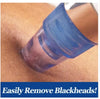 Grofia ™ DermaSuction  Black Head Remover & Pore Cleanser